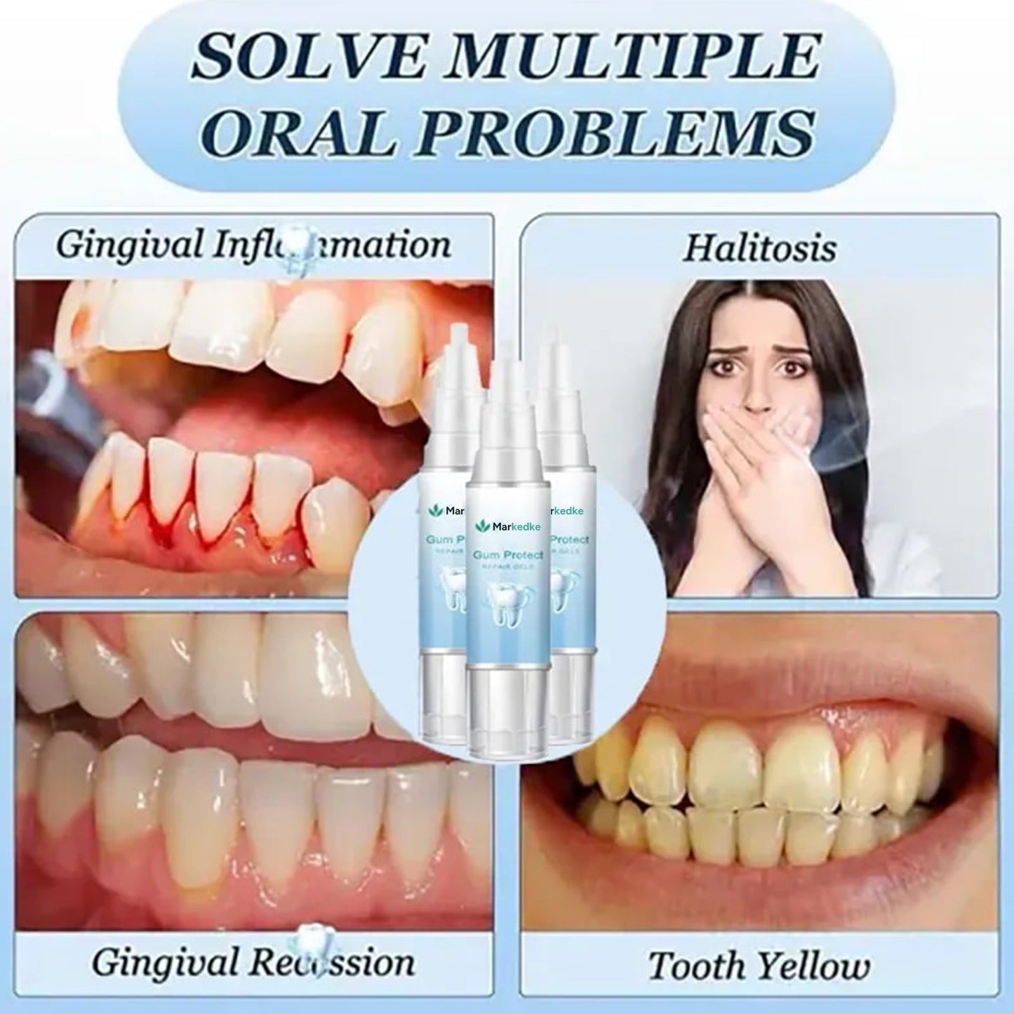 Stop Gum Recession and Bleeding Without Painful Surgery