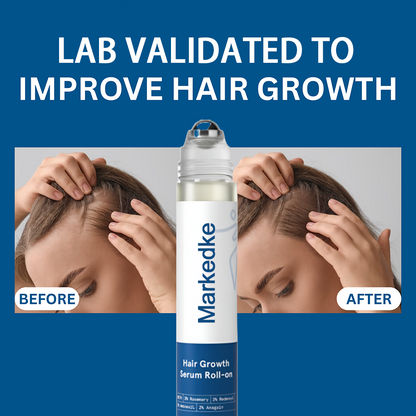 Markedke Hair Growth Roll on Serum
