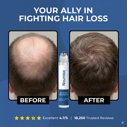 Markedke Hair Growth Roll on Serum