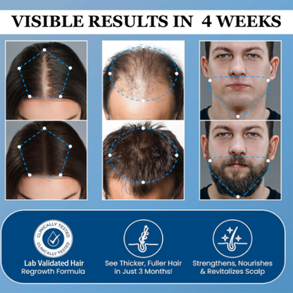 Markedke Hair Growth Roll on Serum