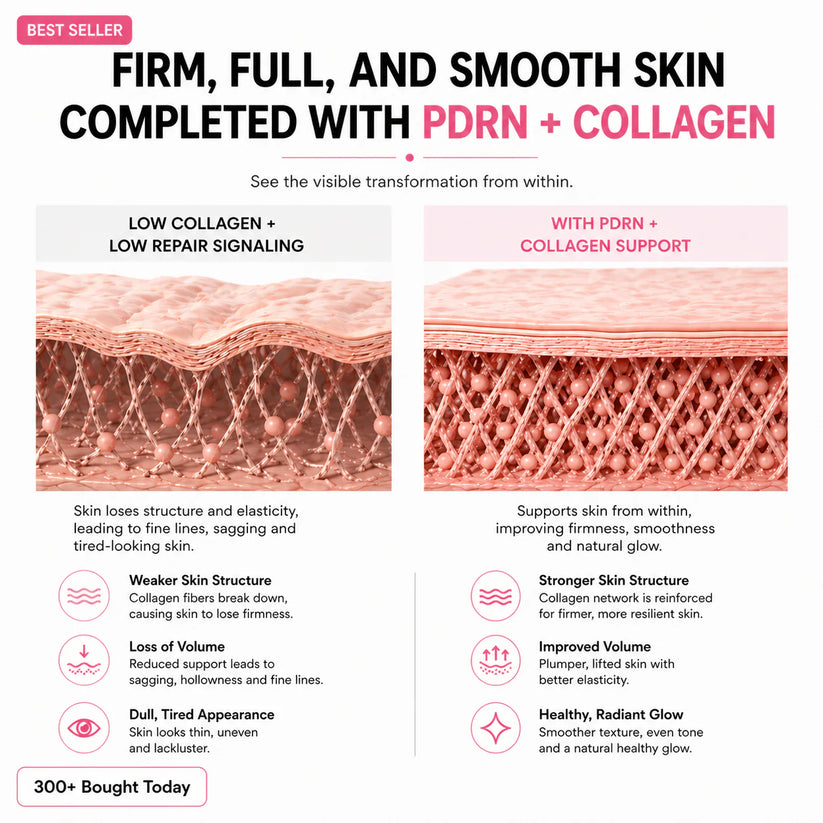🔥LAST DAY 60% OFF Zreuyn Korean Pink CollagenVolume Multi Balm