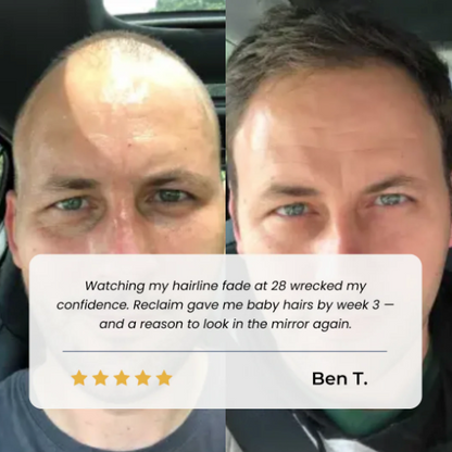 Markedke Hair Growth Roll on Serum